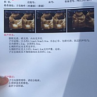 卵泡1.9-1.5cm ，但子宫直肠见不规则液暗区直径约1.1cm ，宫内膜厚1.5cm ，这是卵已经排了吗，还是没排...