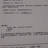 有没有羊水超标的，怎么处理啊，我的医生让我控制饮食