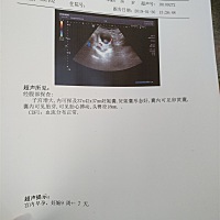 十月份生化一次，这次紧张到不行，终于可以稍微放心啦！希望以后的检查也可以一切顺利！