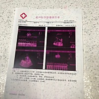 宝宝刚生下来心脏都会有缺口吗？能长好吗，知道的宝妈说下