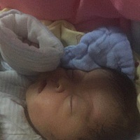 腊月18刨腹产生下女宝，令我心痛的是，生下来和想象中完全不一样，头型很奇怪，眼睛鼓得像青蛙眼，肯定...