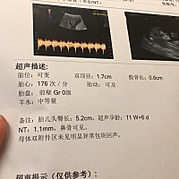 一个下午折腾了三次，nt终于过了，宝宝不配合我，一会坐着，一会趴着，好不容易转过来了，又一直动...