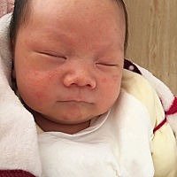 广大的圈友们，我宝宝脸上这是湿气还是火气重造成的呢？求解决方法……