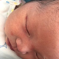 有没有宝妈支支招，宝宝好像湿疹了越来越多了 有什么办法可以解决  每天都有洗金银花水也不见效！急...