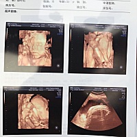 大家帮我看看男孩女孩