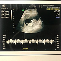 猜男女，不管男女都喜欢，就是好奇，看看大家的经验！