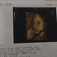 今天做了四维，看宝宝像谁呀