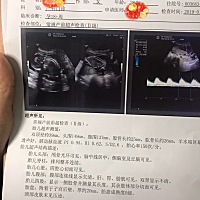 又过关了！ 各位姐姐 阿姨们！帮看看是佩琦还是乔治吖！