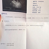 检查6周➕，有孕囊没有胎芽，正常么？