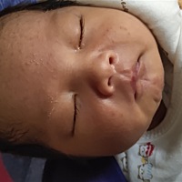 bb脸上有红点，医生说自己会好的，现在出生一周了，还是这样呢，其实这是什么来的？