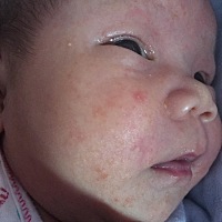 为宝宝操碎了心哪，各位宝妈们都是怎么解决宝宝这种问题的，宝宝快30天了，脸上可能出的也是湿疹，天气...