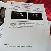 大家帮我看下这是什么情况