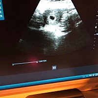 谁能看出来这个形状是男孩还是女孩。