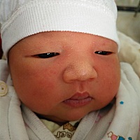 宝宝今天第11天了，嘴巴上有一层厚厚白白的皮，想问下有没有其他宝宝跟我们一样？？？要怎么处理？