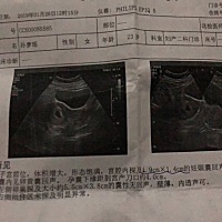 有没有懂的帮我看一下，注意B超日期，5天内没有长大还小了一点？