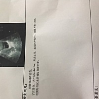 图片里什么呀！我看不懂