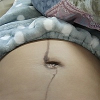 这松弛的肚皮啥时候恢复😒