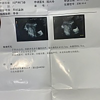 上次1月22号做B超没有检查到孕囊不说，而且还有多个囊性回声，今天1月号隔了8天又去检查B超，检查出了孕...