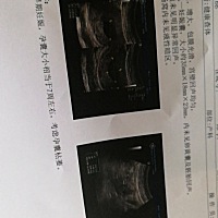 没戏了，11周做B超才七周，又没见胎心和孕襄。