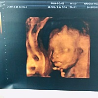 今天的四维可谓是一波三折，医生喊了我无数次我在大厅竟然没听到，把医生急得呀！后来打了电话才知道我...