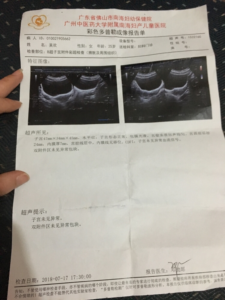 唐筛一次通过，开心😄