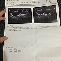 唐筛一次通过，开心😄