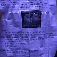 孕7周，胎囊45*25*44是男孩女孩啊？有会看的吗？