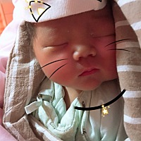 求助：乳头皲裂严重，求越快越好的方法！看着孩子哭，好心疼！