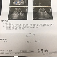 我第一次怀孕 有经验的妈妈能告诉我是男孩女孩呗 谢谢了