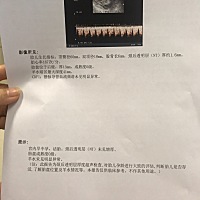 刚做的NT,看不懂