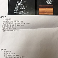 刚刚NT顺利通过，有没有宝妈、胎盘下界达宫颈口内的