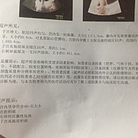 怀孕48天，怀孕之前就有盆腔积液的情况，这是刚做的彩超，医生说先兆流产，挺害怕的，上厕所没有出血，...