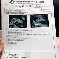 NT一切顺利✌️