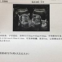 去检查医生说数值都挺好，让我年后初十再去复查，不知道是复查什么？有谁知道吗？