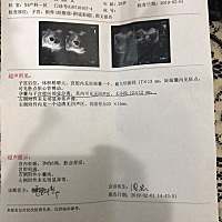 有没有姐妹孕囊与宫壁分离保胎成功的？ 图一是B超单，图二是第一次抽血结果，图二是昨天抽血结果，医生...