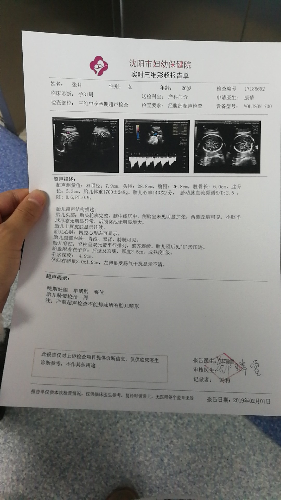 医生说是个大长腿，就是不知男娃女娃！越来越好奇了！