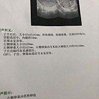 大家帮忙看看，这是要排卵了吗？有的说快了，有的说还要两天