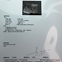 NT顺利通过，可以开开心心过大年啦，感恩🙏