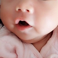 四维说宝宝没鼻骨，去了三家医院做B超也说没鼻骨，可是生下来是大鼻子，高鼻梁