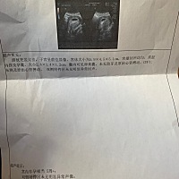 从早上吐到下午，吃什么吐什么，去医院检查一下希望没事，医生看见我女孩说你妈妈要给你生小弟弟了，不...