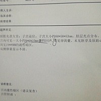 谁知道是怎么回事