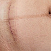 剖腹产术后两小时那个疼真的是无法形容，尤其宫缩时候，我猜顺产更疼吧。宝宝今天15天了，坐月子期间基...