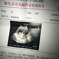 怀孕12周，期待很久的宝宝小人样照片出炉了，心里美滋滋的，说不出来的感觉，初为人母，余生还请你多多...