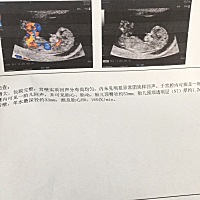 除旧迎新！愿家人年年身体健康、财源广进！     最大愿望 来个佩奇