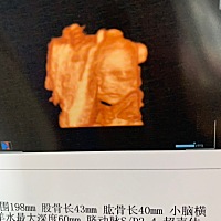 接好孕，四维顺利通过，小棉袄