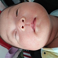 这是什么该怎么办😱心疼