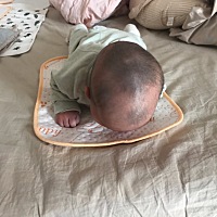 为啥剃了胎毛变这样？什么问题？枕秃？