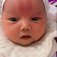 各位宝妈们，你们看下宝宝额头上长的是什么啊，医生说不知道是血管瘤还是胎记只叫我们先观察，请问有同...