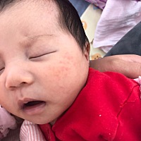 这是要长什么呀。怎么预防呀