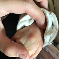 红了  肿  怎么回事